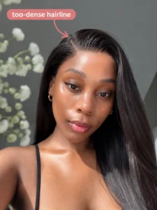 Too-dense wig hairline example showing an unnatural thick hairline