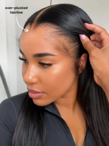 Over-plucked wig hairline example showing excessive thinning around the front